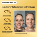 Brosse de drainage lymphatique Galerie